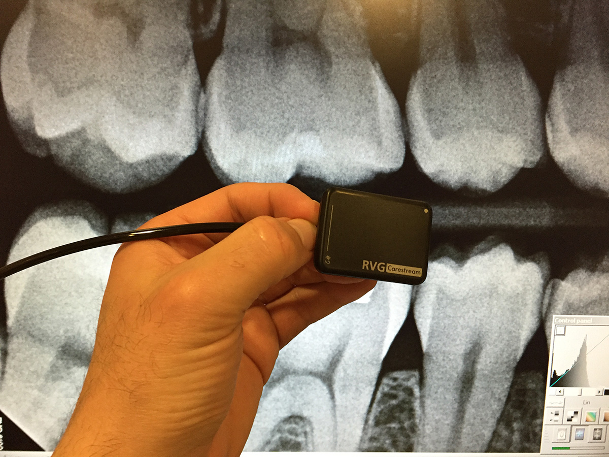 Dental digital radiographs
